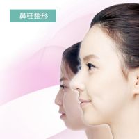 悄悄的差异 鼻柱的宽度 调和鼻柱子印象-鼻柱整形-韩国佰诺佰琪(原：巴诺巴奇)整形外科