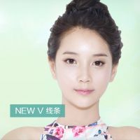 瘦脸+Doublo激光+V提升综合面部提升- NEW-V-线条-韩国佰诺佰琪(原：巴诺巴奇)整形外科