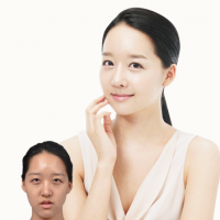 双颚修复术 令人惊奇的细腻至1mm的技术-韩国灰姑娘整形医院