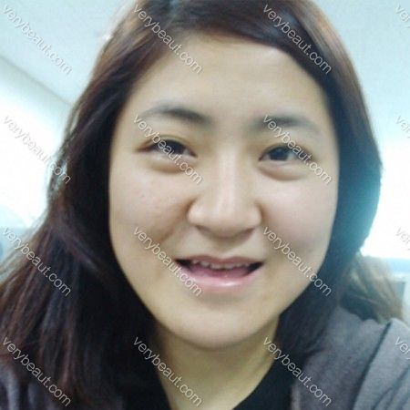 我去韩国做了vline和面部吸脂，从此四方脸变小V脸！—韩国原辰整形外科医院整形案例