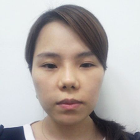 明星风的眼部鼻和鼻部修复+脂肪移植—韩国灰姑娘整形医院整形日记
