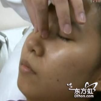 女子微晶瓷隆鼻 误打入血管致眼睛失明
