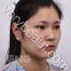 鼻子+下颌角 韩国GNG整形术后大变脸—韩国GNG整形医院