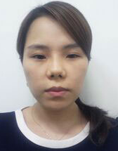 女神整形外科——做完眼睛鼻子真的变身女神_韩国女神整形外科