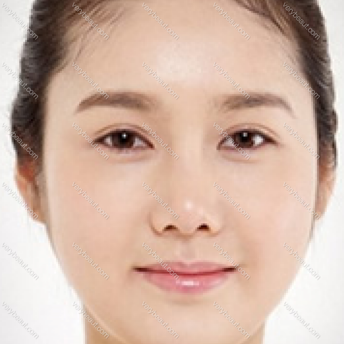 小眼单眼皮——S自然粘连双眼皮术打造电眼—韩国SY整形外科整形案例