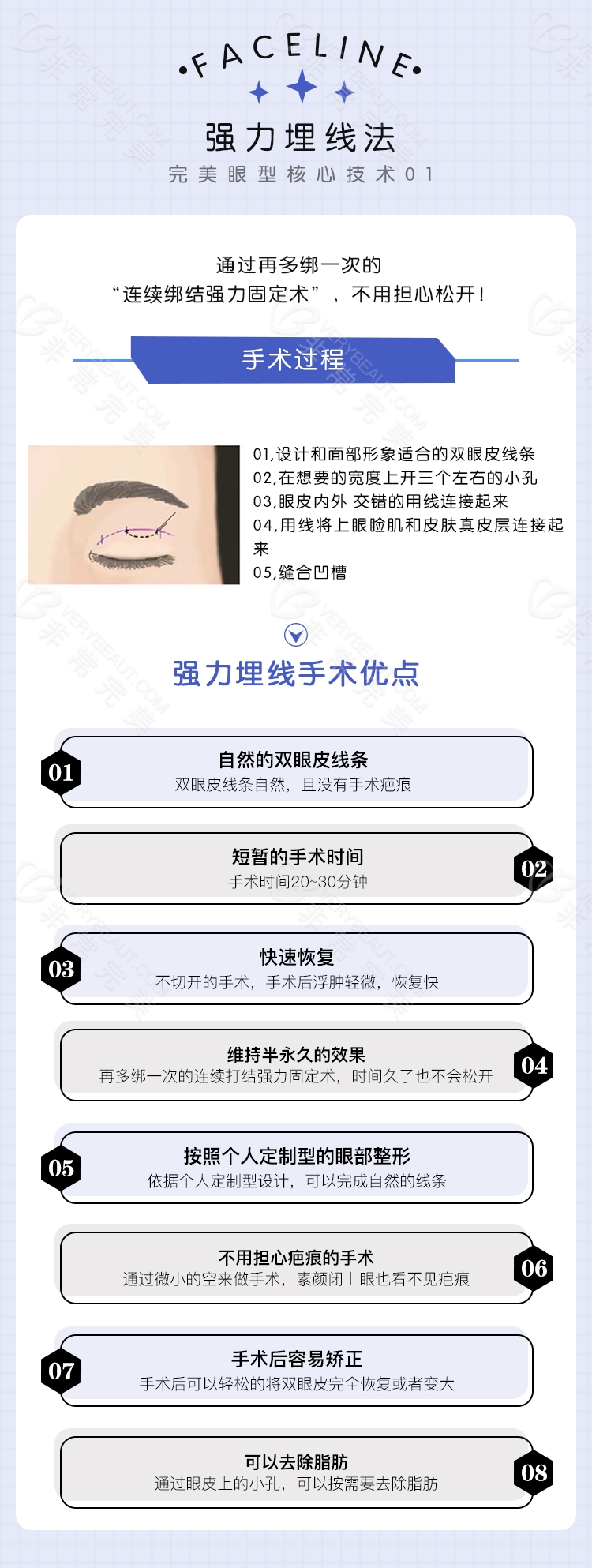 完美眼部整形开眼角