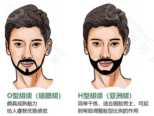 男性胡须种植设计风格