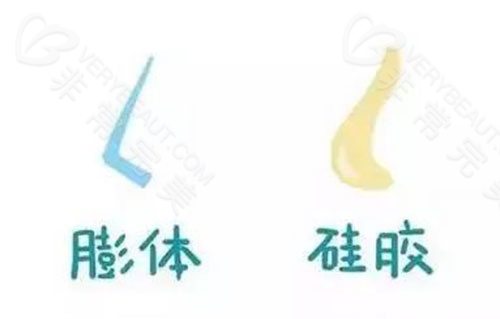 膨体假体隆鼻材料示意图