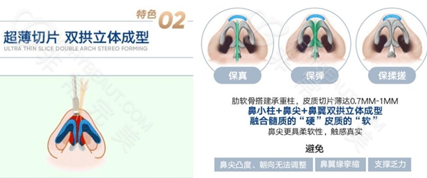 成都市西区医院8C骨雕鼻超薄切片双拱立体成型技术图