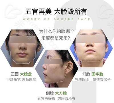 面部哪些问题需要做磨骨手术