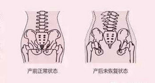 缩阴手术示意图