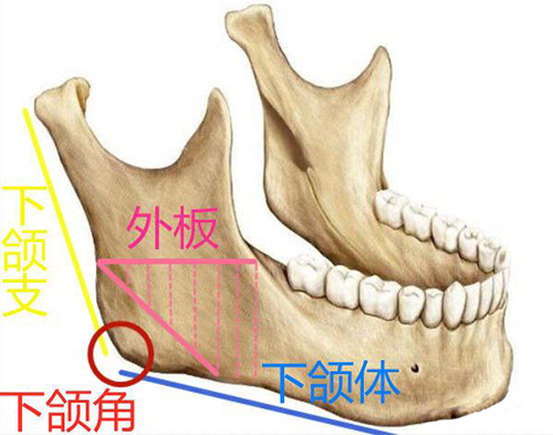 长曲线下颌骨必须做外板吗?公开下颌角劈外板效果及意义!