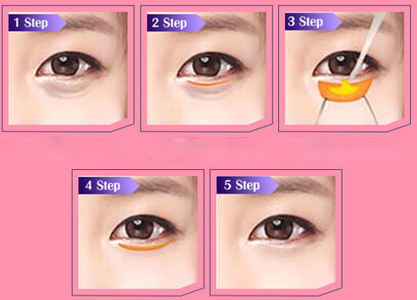 眼袋怎么消除简单方法图片