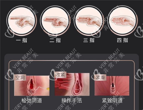 阴道松弛的不同程度