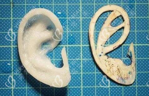 耳再造使用材料