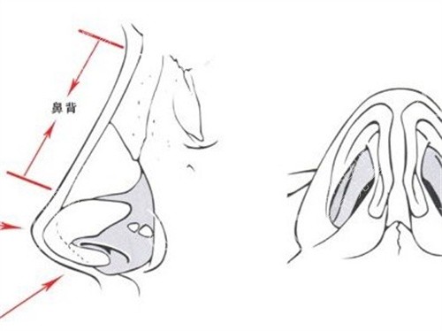 鼻背在哪个位置图片图片