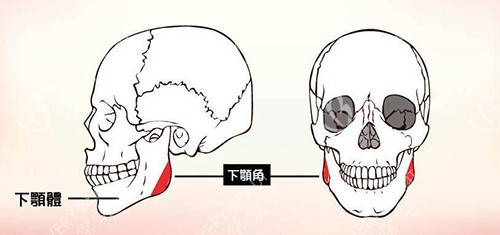 下颌角磨骨改善卡通图展示