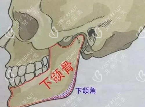 下颌角磨骨卡通图展示