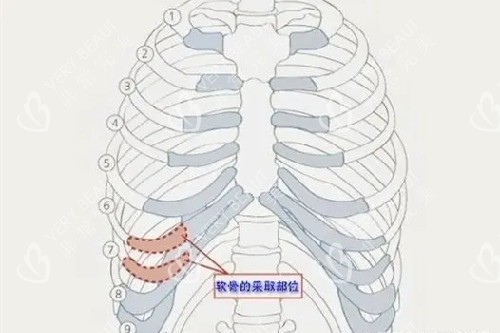 耳再造取肋软骨的位置