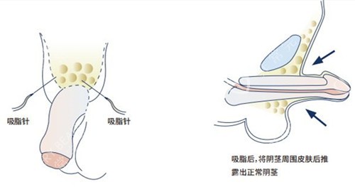 男生怎么变大变粗变长图片