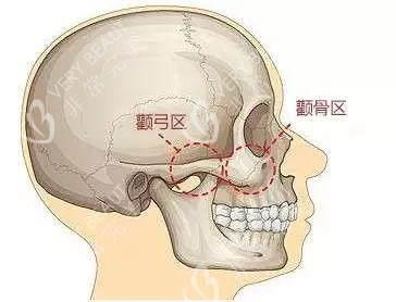 颧骨颧弓区示意图