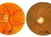 青光眼能做晶体植入吗？换晶体后能恢复正常视力吗？