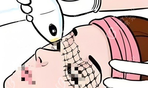 光电医美项目卡通图