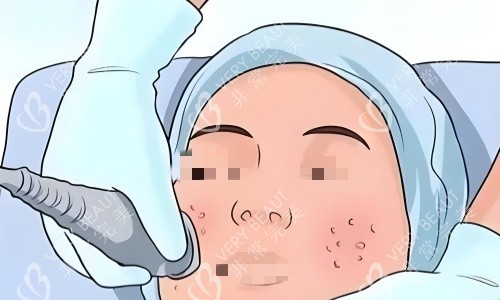 光电医美项目动画图