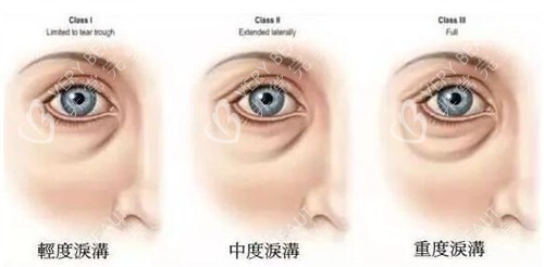 面部纹路展示图照片