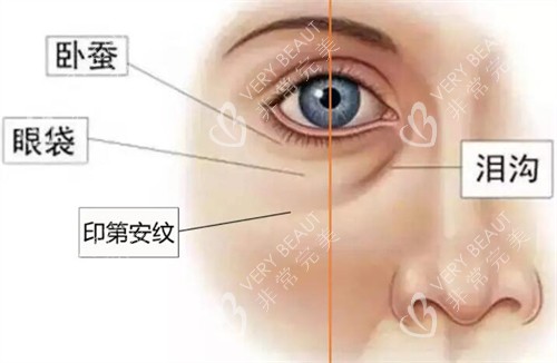 面部印第安纹长什么样