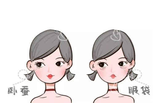 卧蚕、眼袋卡通对比图