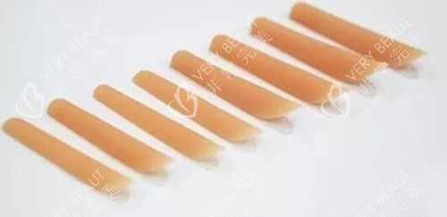 硅胶假体隆鼻照片