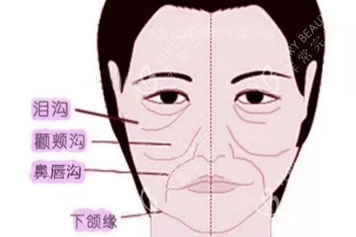 面部皱纹卡通图