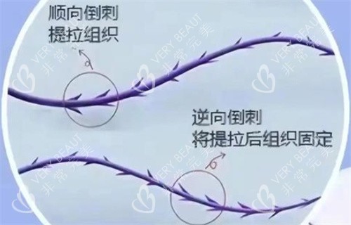 倒刺形状线材样子图解