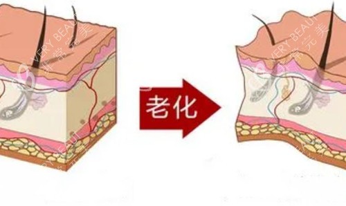 皮肤老化对比卡通示意图