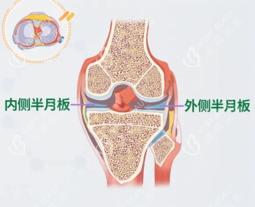 半月板内外侧示意图