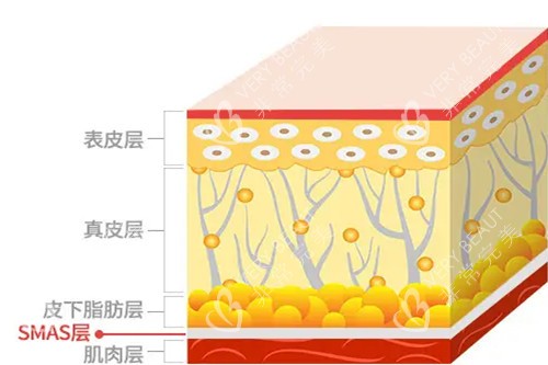 皮肤筋膜层卡通示意图