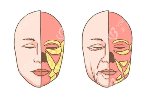 面部衰老卡通图对比