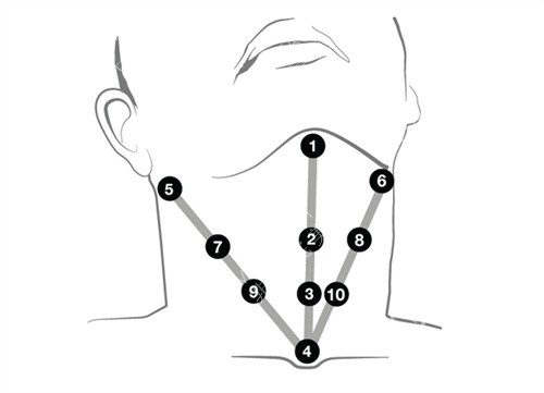 profhilo逆时针颈部注射点位