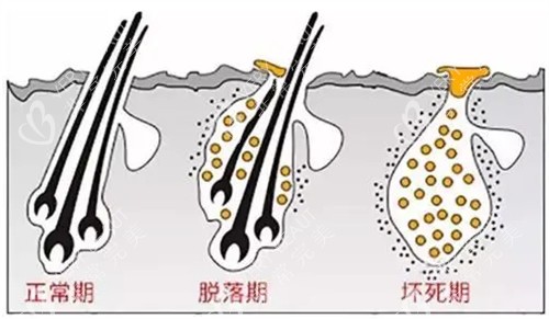 头发生长周期图解