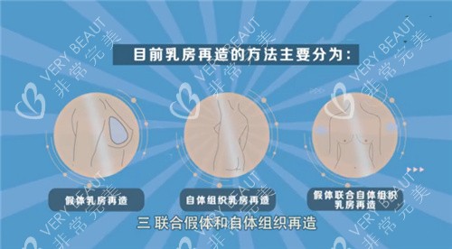 乳房再造手术方式