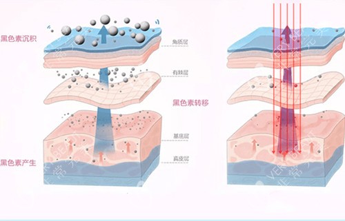 皮肤美白内部作用层次示意图