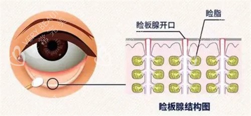 眼睑板结构图