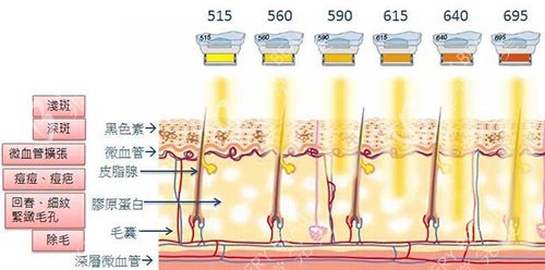光子嫩肤原理图