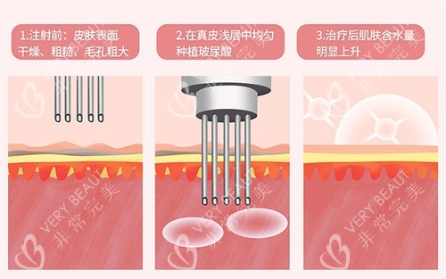 水光前后皮肤对比