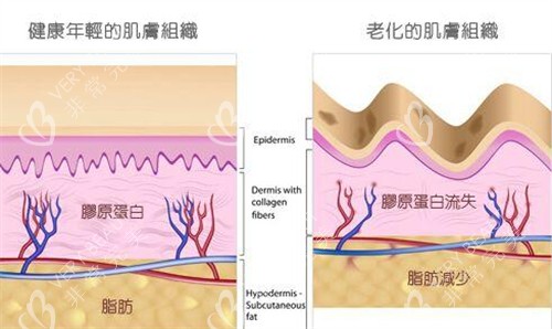 注射童颜针前后对比