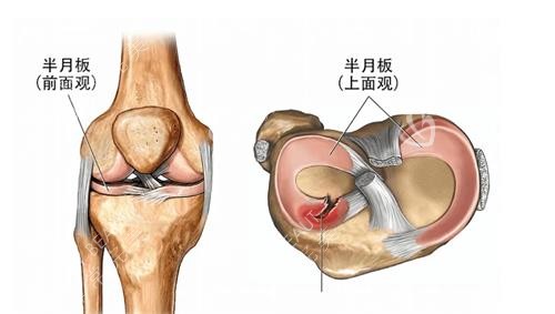 半月板的多方位展示图