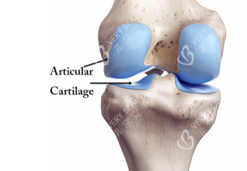 膝关节卡通示意图