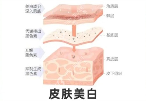 皮肤美白