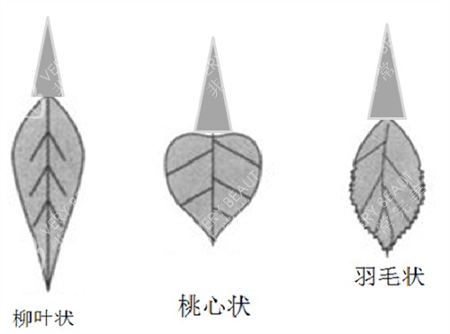 阴唇形状